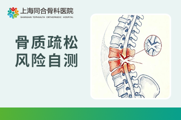超90%骨质疏松患者不知情？花一分钟自测，及早发现风险